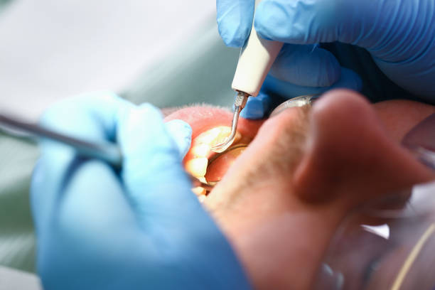 Reliable NC Emergency Dental Service Solutions