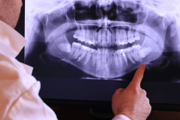 Best Urgent Dental Care for Toothaches in Oak Ridge, NC